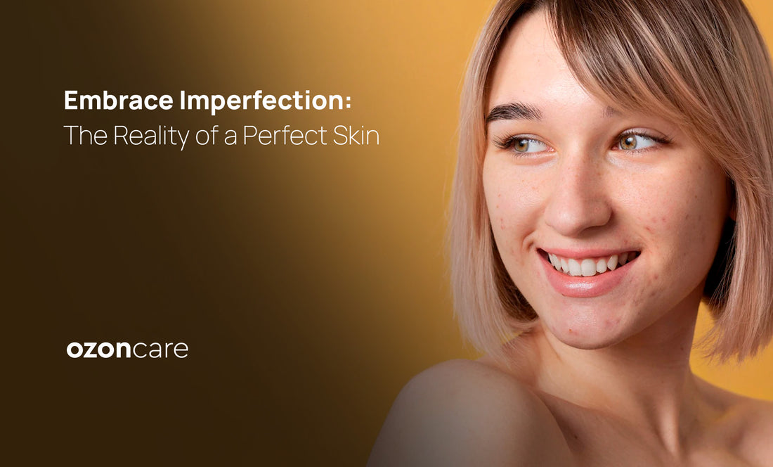 Embrace Imperfection: The Reality of Perfect Skin