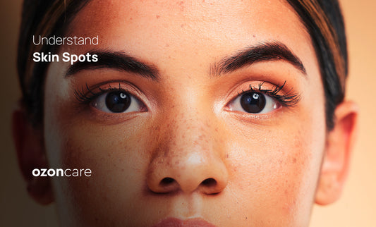 Understand Skin Spots