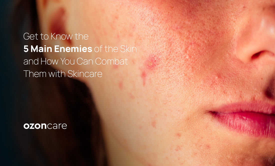 Get to Know the 5 Main Enemies of the Skin and How You Can Combat Them with Skincare